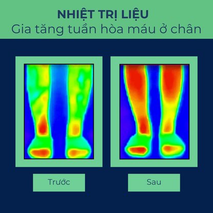 CalfCare - Thiết bị massage khí nén bắp chân